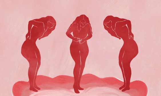 Living with Endometriosis